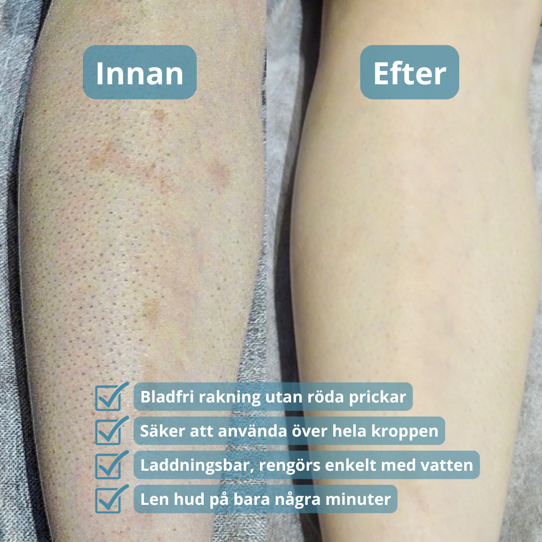 Bostila™ - Premium Rakhyvelsfri Rakning utan Irritation