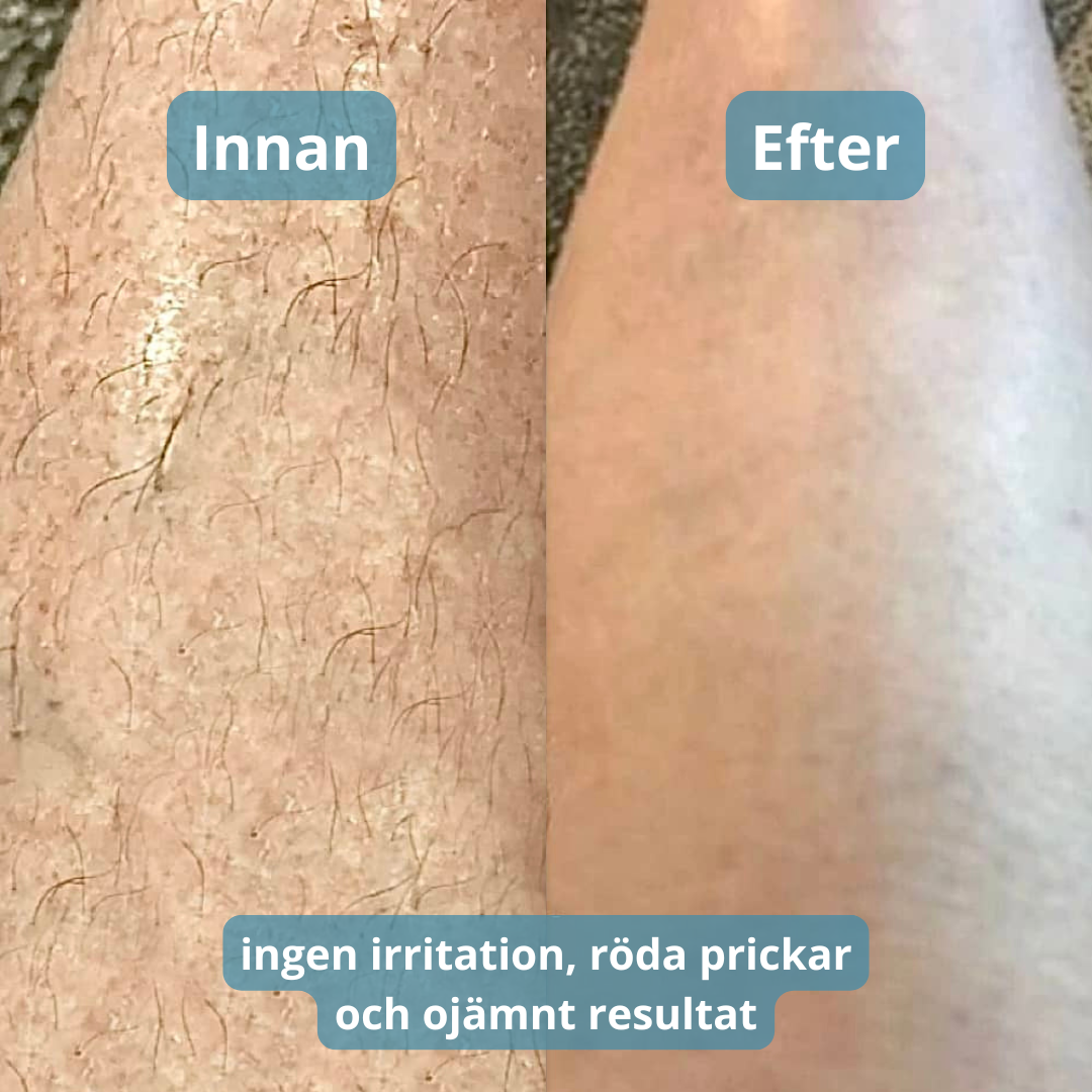 Bostila™ - Premium Rakhyvelsfri Rakning utan Irritation